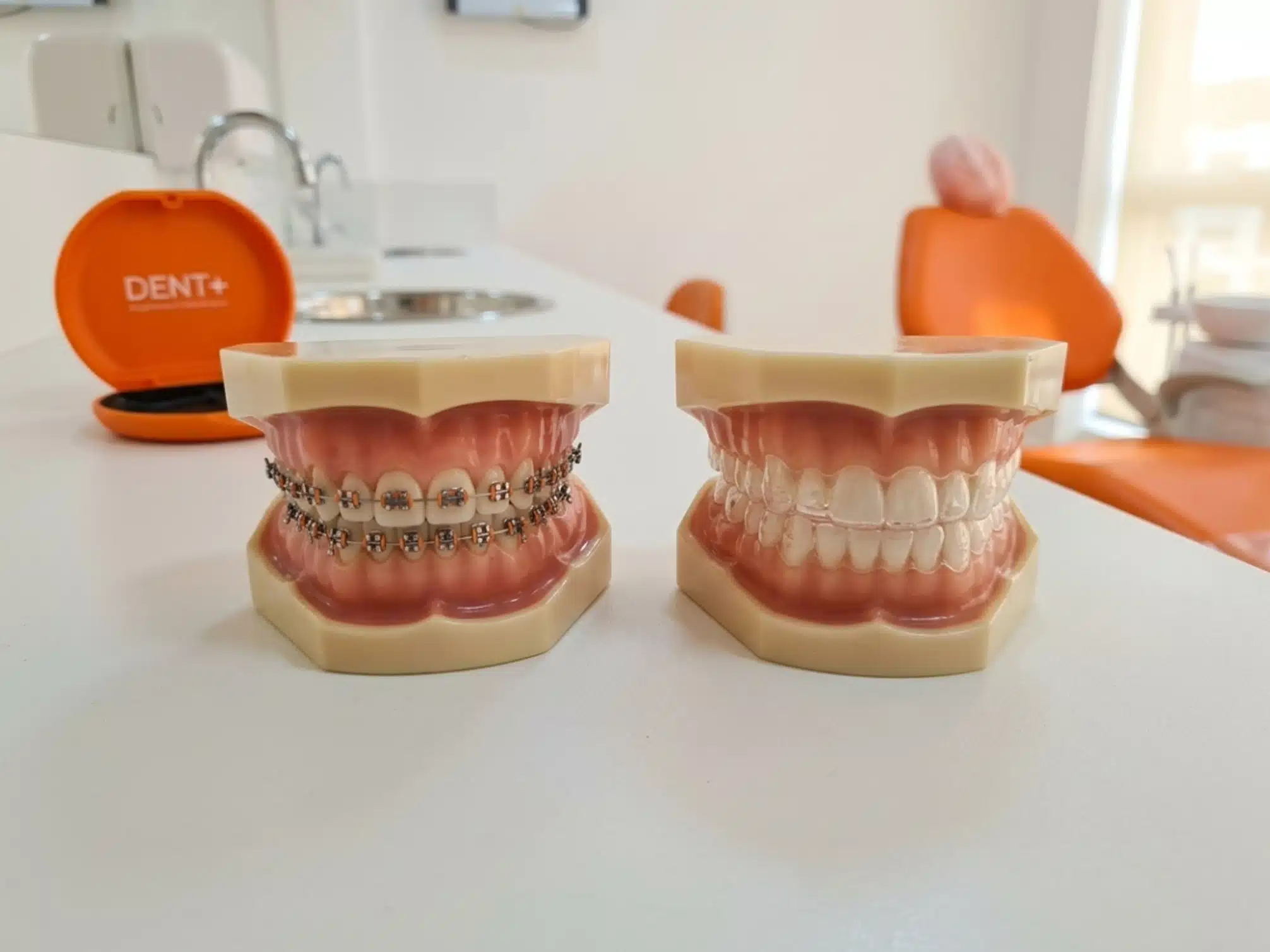 Comparativo entre modelo com aparelho fixo metálico e modelo com alinhador invisível transparente sobre bancada da DENT+