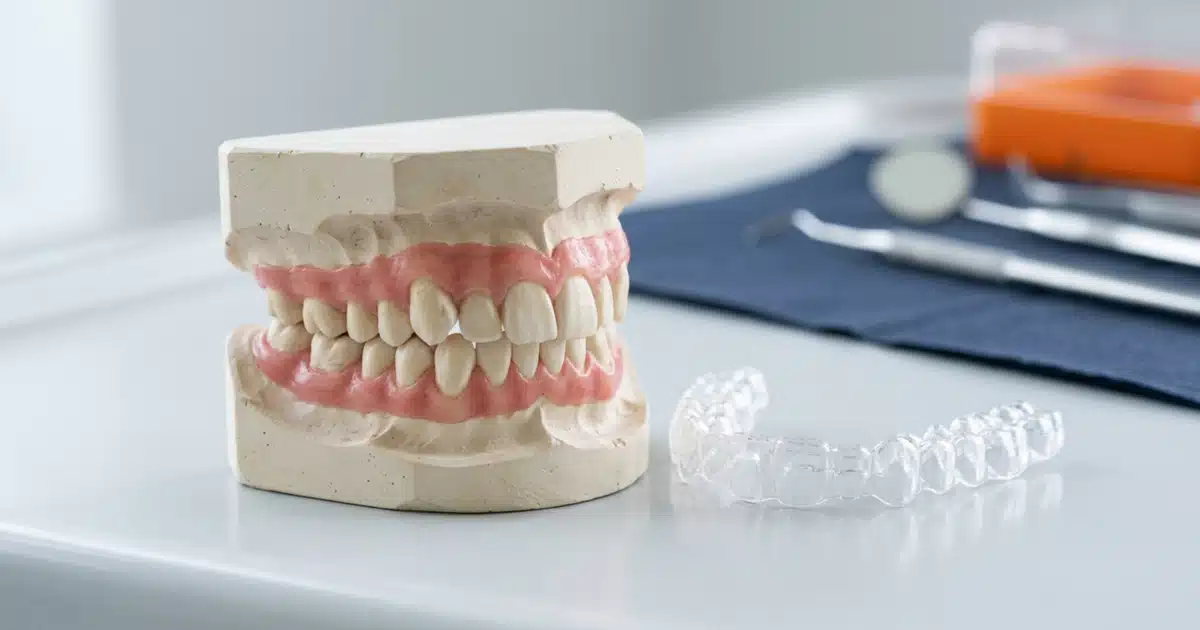 Modelo dental mostrando apinhamento ao lado de um alinhador invisível na DENT+