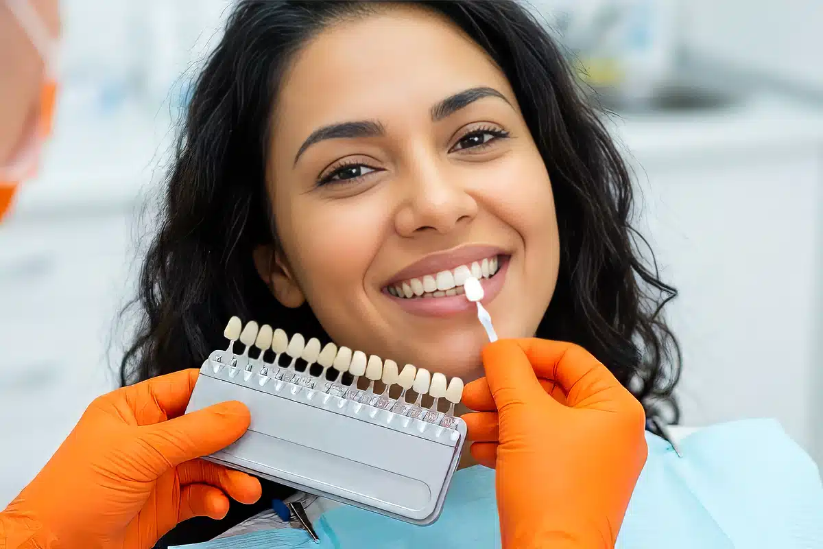 Paciente sorrindo durante avaliação de cor dos dentes com escala VITA antes do clareamento na DENT+ Niterói